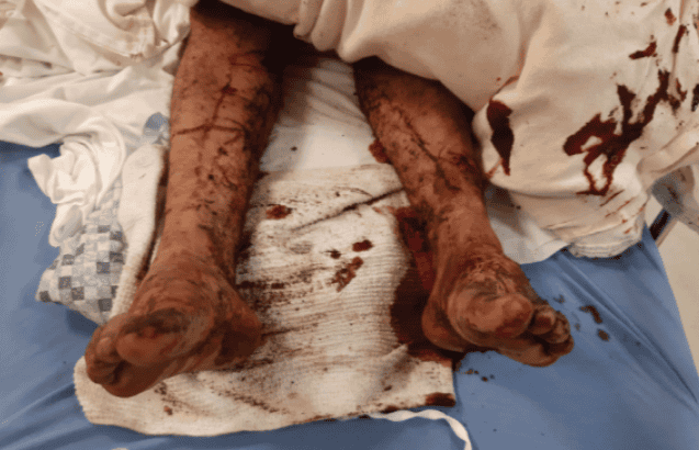 $1M por Ataque de Perros con Lesiones Graves